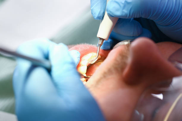 Best Knocked-Out Tooth Emergency  in Orlando, FL