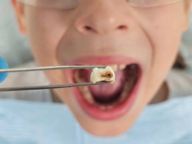 Best Dentist for Dental Trauma  in Orlando, FL